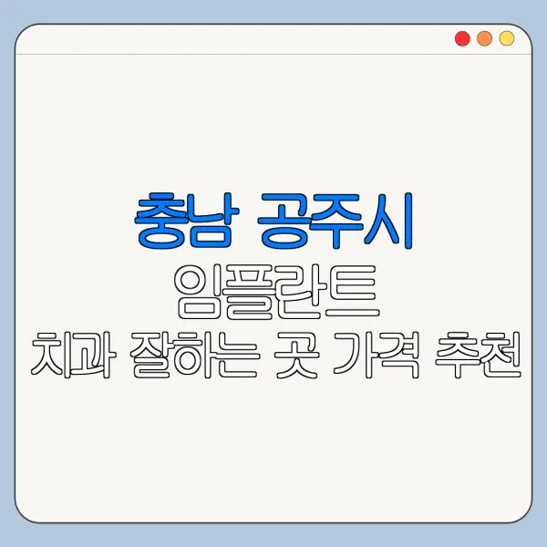 충남 공주시 임플란트 치과 잘하는 곳 가격 추천